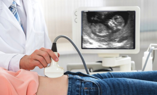 中国超声市场龙头之战，GE医疗、飞利浦、迈瑞贴身肉搏！