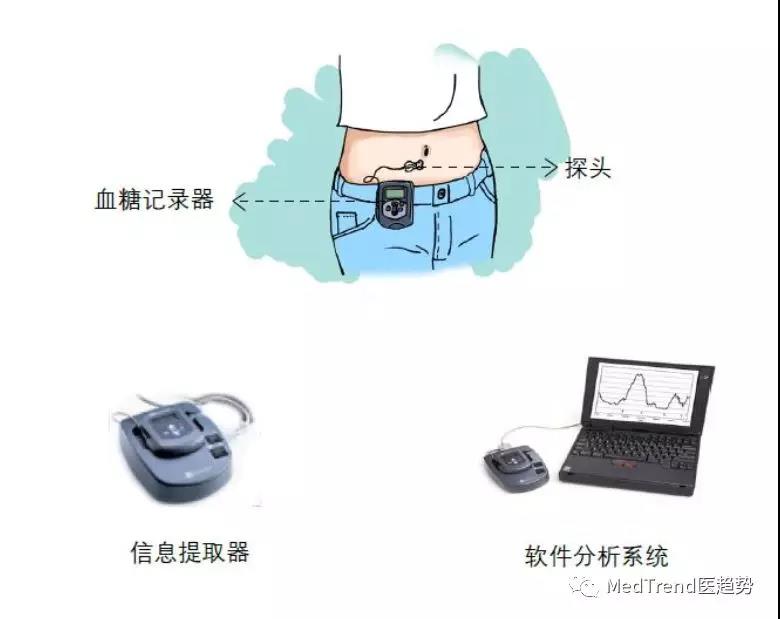 freestyle libre是雅培糖尿病護理公司