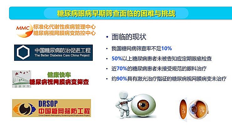 新知图谱, 全国智能眼科学组组长袁进：我们为什么要做一份修改 50 多稿的眼科 AI 筛查指南？