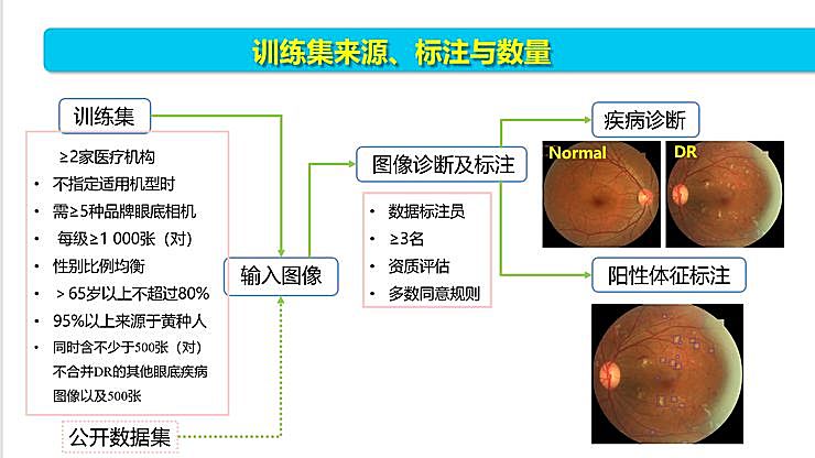 新知图谱, 全国智能眼科学组组长袁进：我们为什么要做一份修改 50 多稿的眼科 AI 筛查指南？