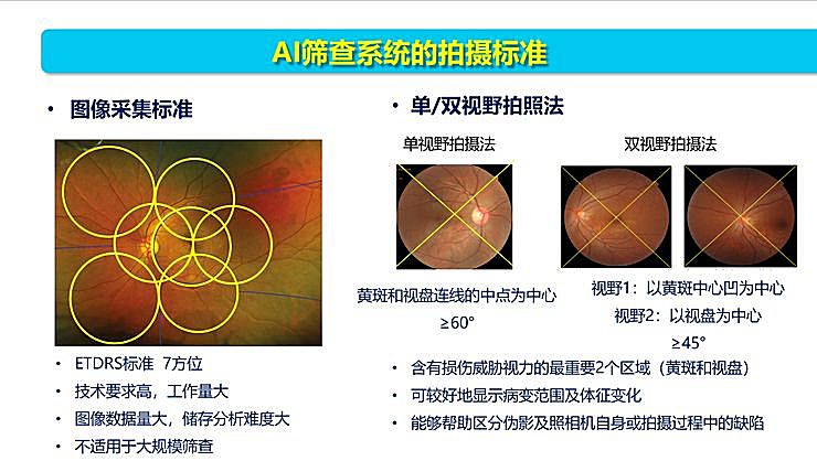 新知图谱, 全国智能眼科学组组长袁进：我们为什么要做一份修改 50 多稿的眼科 AI 筛查指南？