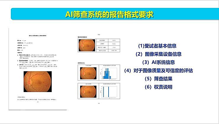 新知图谱, 全国智能眼科学组组长袁进：我们为什么要做一份修改 50 多稿的眼科 AI 筛查指南？