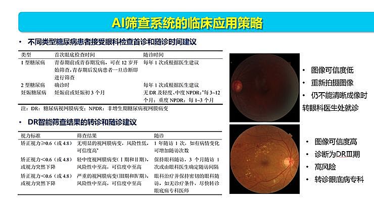 新知图谱, 全国智能眼科学组组长袁进：我们为什么要做一份修改 50 多稿的眼科 AI 筛查指南？